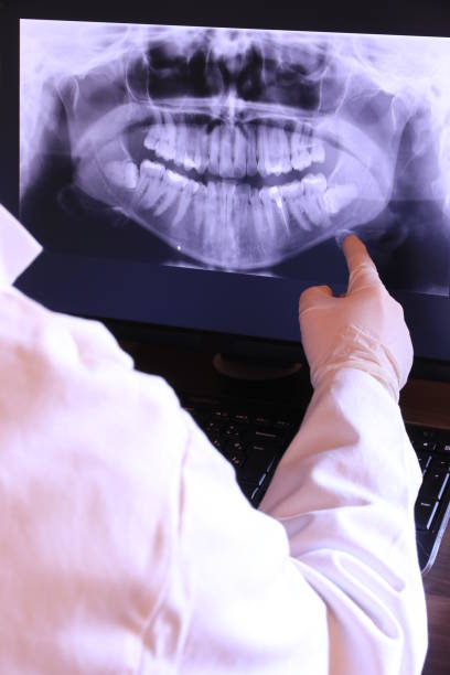 Best Walk-In Emergency Dentist in Marina, CA